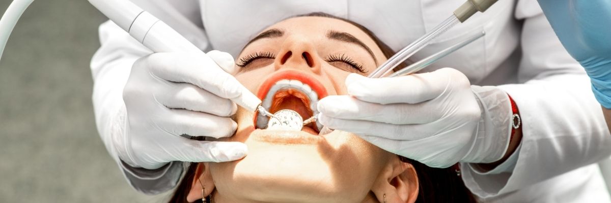 Beylikdüzü Diş Bonding Uygulaması